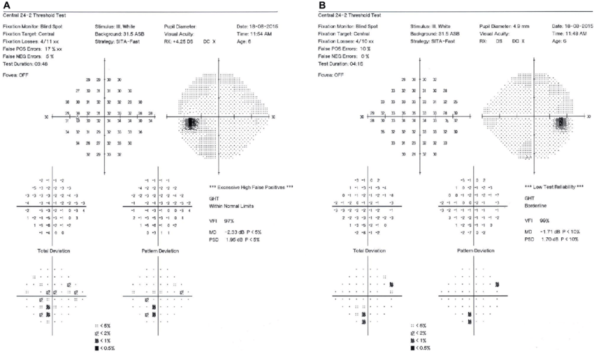 Visual Field Pic 2